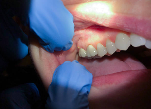 Best Pediatric Emergency Dentist in Chisholm, ME